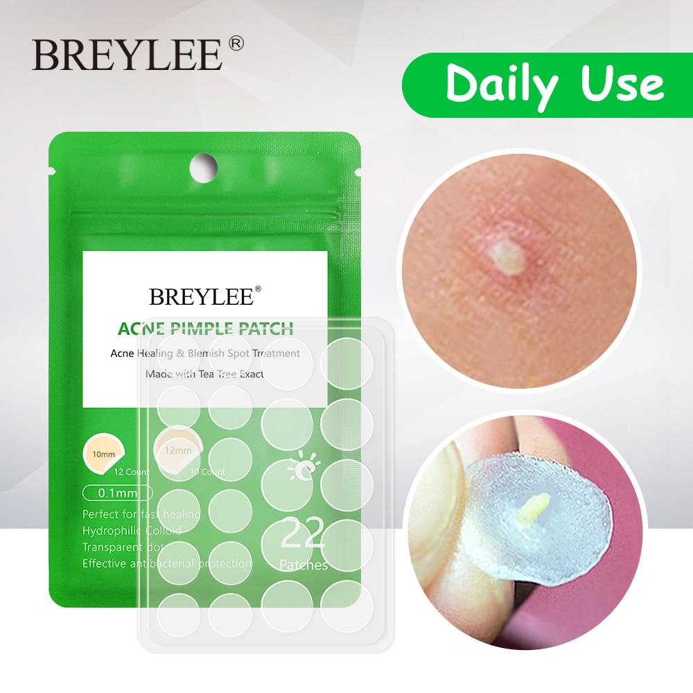 BREYLEE Acne Pimple Patch Acne Treatment Stickers Pimple Remover Tool Blemish Spot Skin Care Face Mask Acne Cream Daily Use