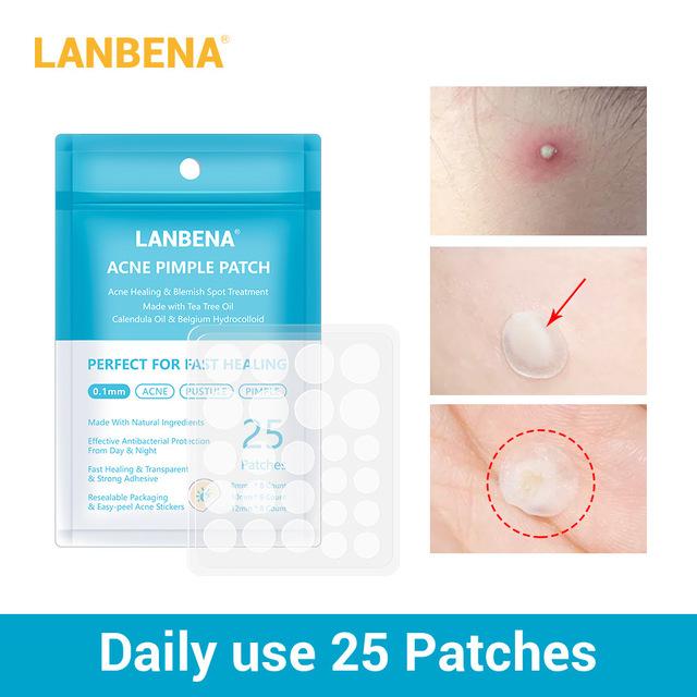 LANBENA Face Mask Acne Treatment Facial Mask Skin Care Acne Pimple Remover Tools Patches Stickers Black Mask Peeling Face Masks