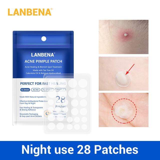 LANBENA Face Mask Acne Treatment Facial Mask Skin Care Acne Pimple Remover Tools Patches Stickers Black Mask Peeling Face Masks