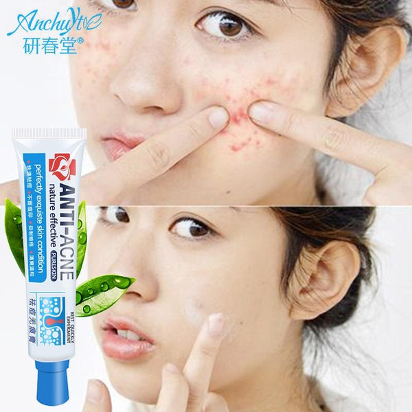 ANCHUYT Chinese medicine ointment acne treatment remove acne scars and tracks balance oil greasy skin shrink pore skin care gel