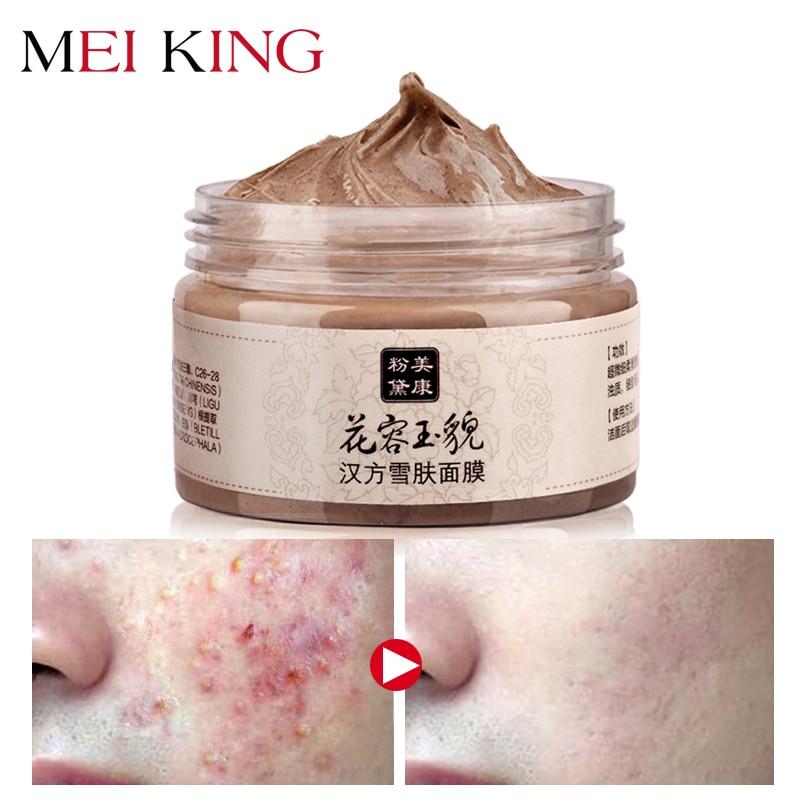 MEIKING Blackhead Face Mask Deep Cleansing purifying peel off the Black head Whitening Moisturizing Facial Masks Skin Care 120g